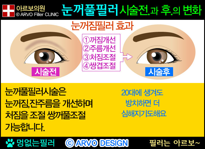 Ǯʷ,ʷ,Ǯʷ,Ǯʷ,εʷ,20봫Ǯʷ,20봫