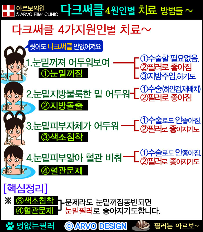 눈밑꺼짐필러,눈밑필러4가지타입5