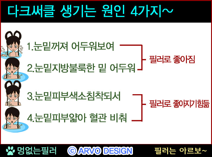 눈밑꺼짐필러,눈밑필러4가지타입6