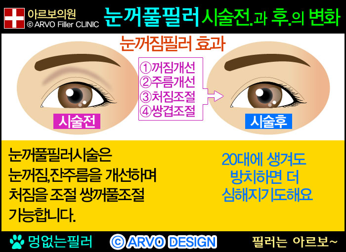 Ǯʷ,ʷ,Ǯʷ,Ǯʷ,εʷ,20봫Ǯʷ,20봫