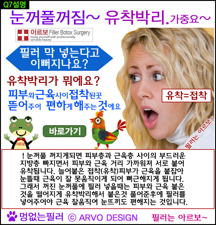 눈꺼풀필러,눈꺼풀필러유착박리,유착박리